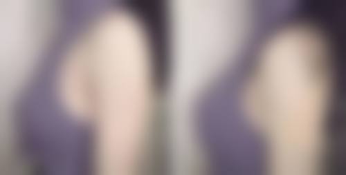 六、合肥维多利亚整形外科医院价格表