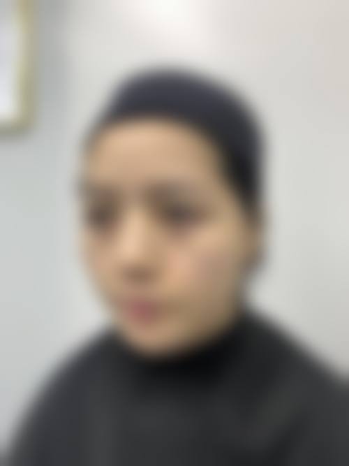 贵阳唯美整形美容真实的患者评价