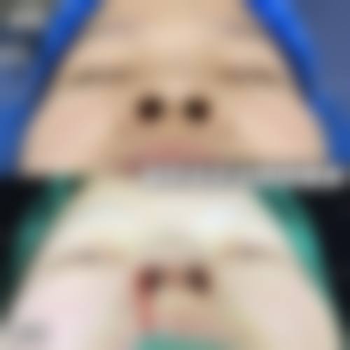 八、郑州一美整形美容医院预约方式