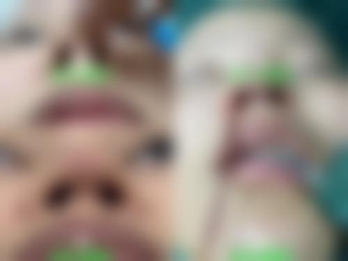 二、郑州一美整形美容医院怎么样？