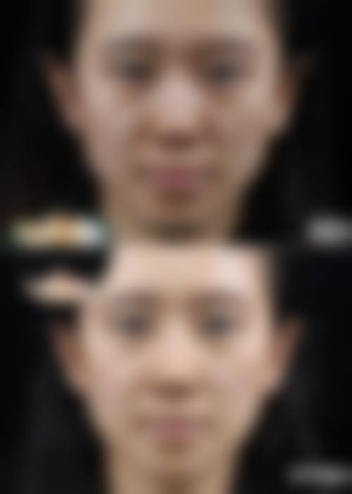 四、中山市尹姬美容特色项目