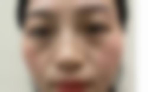 四、锦州海峰整形医疗美容诊所特色项目