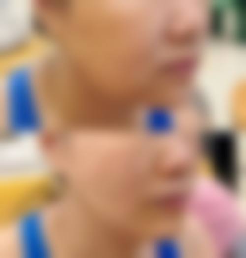 八、珠海红妍医疗美容诊所真实的患者评价