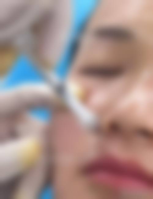 四、珠海红妍医疗美容诊所特色项目