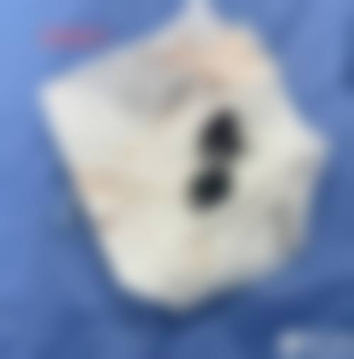 四、哈尔滨雍禾医疗美容门诊部特色项目