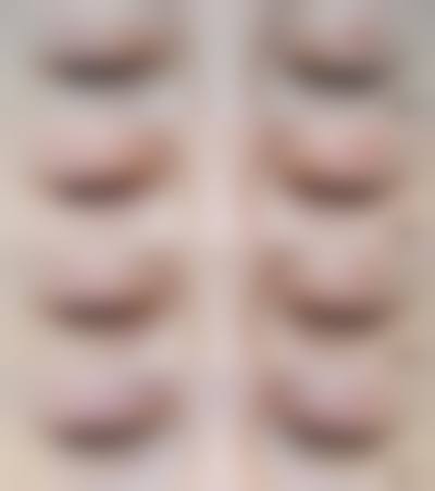 五、成都武侯春语医疗美容门诊部价格表