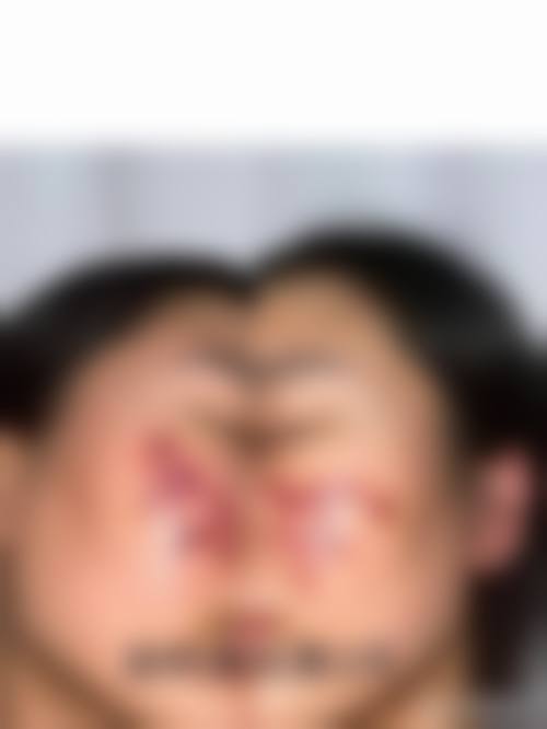 三、北京漾柏净加整形医院诊疗项目有哪些？