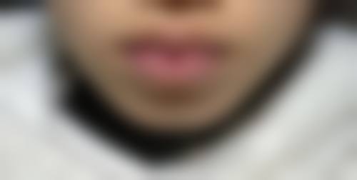 六、锦州海峰整形医疗美容诊所价格表