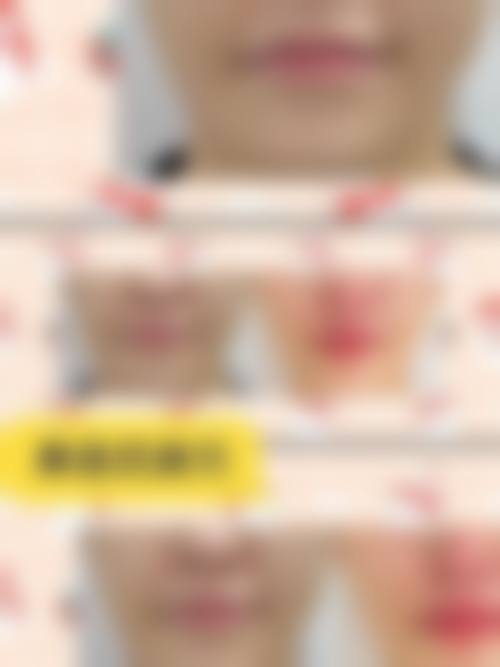 四、上海施妍整形医院特色项目