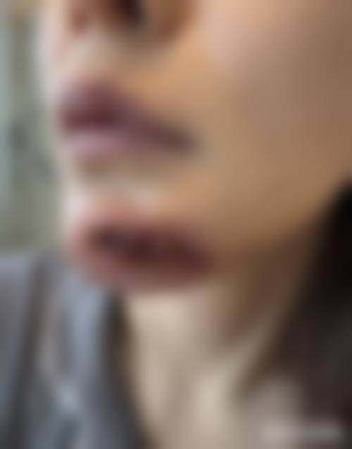 六、哈尔滨雍禾医疗美容门诊部价格表