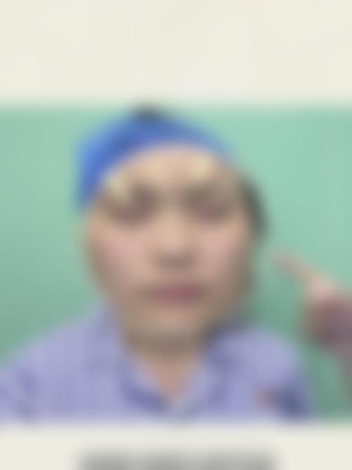 贵阳唯美整形美容价格表