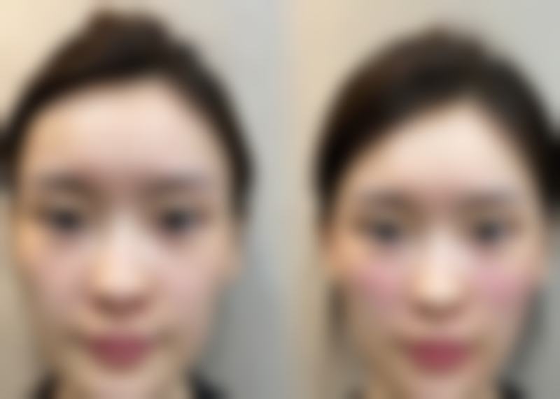 九、郑州一美整形美容医院真实的患者评价