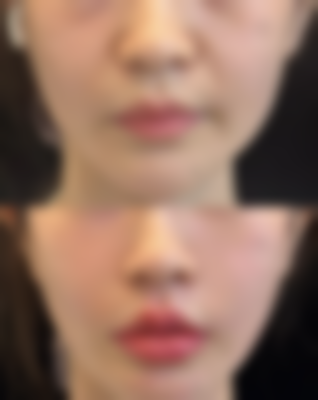 贵阳唯美整形美容特色项目