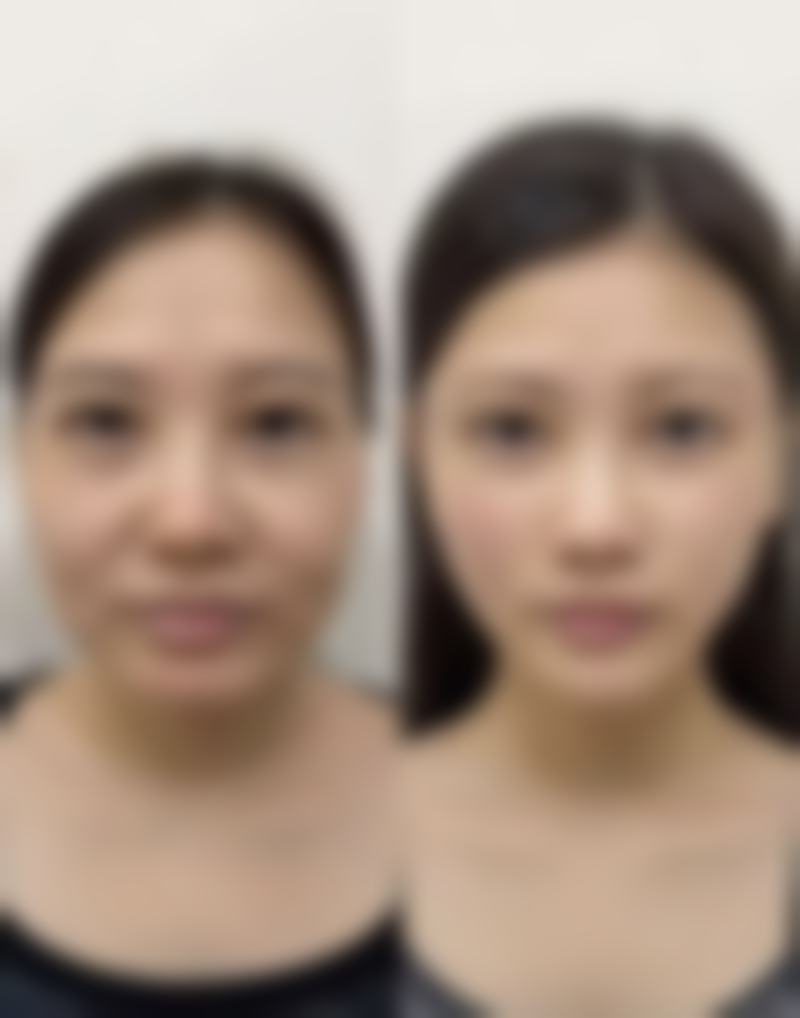 五、襄阳健桥整形医院价格表