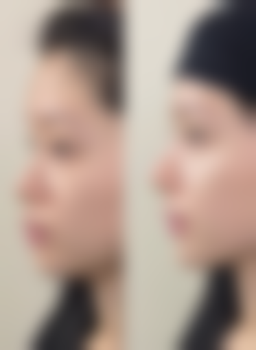 七、襄阳健桥整形医院预约方式