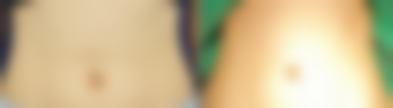 二、为什么姨妈期间埋线双眼皮要谨慎？身体变化来解答