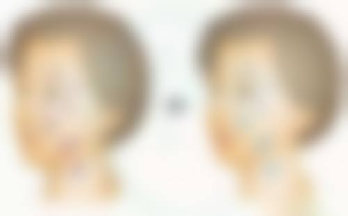 {白色疤痕怎样修复？掌握这些方法或能实现快速修复，让肌肤重焕光彩！ 