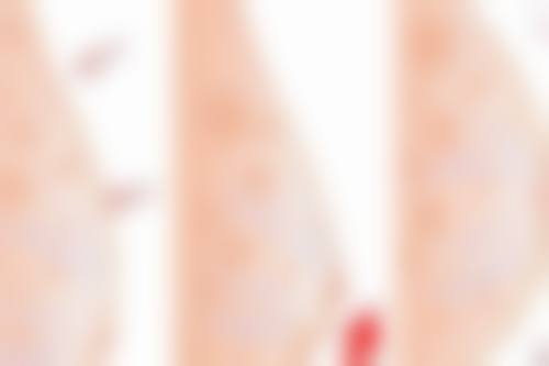 二、安庆市第六人民医院整形科怎么样？