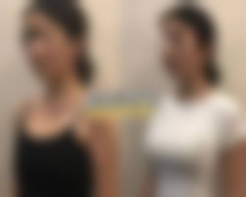 三、TCB中央美容外科仙台广濑通诊疗项目有哪些?