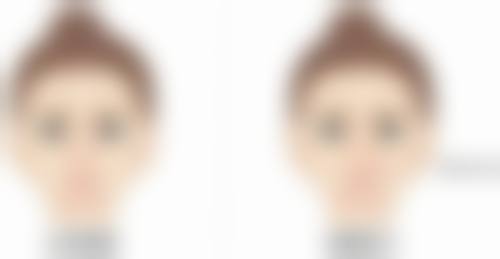 四、抽脂修复阶段的身体变化和注意事项