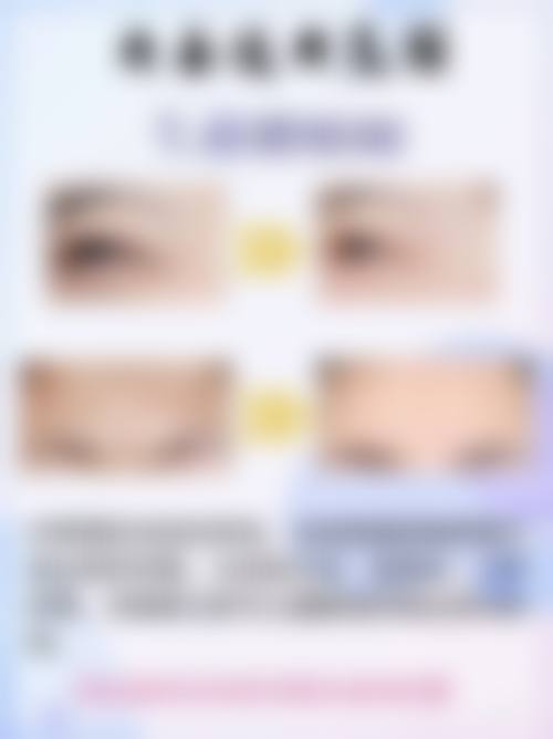 一、了解去眼袋眼霜的关键成分