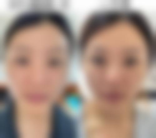 六、CLINICX无创微整形中 心价格表