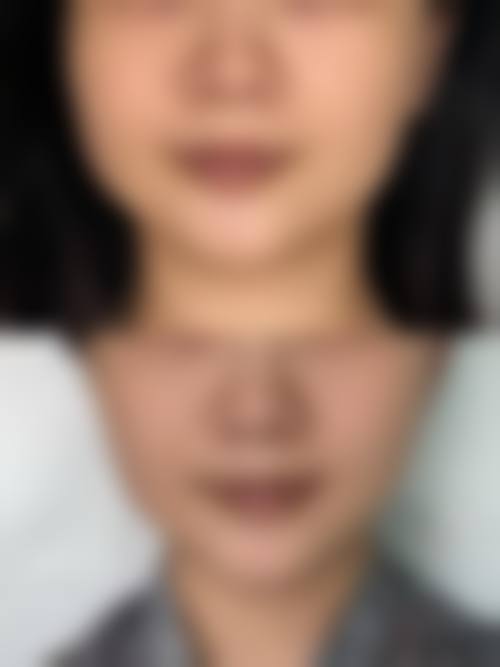 二、中山佩妍医疗美容门诊部怎么样?