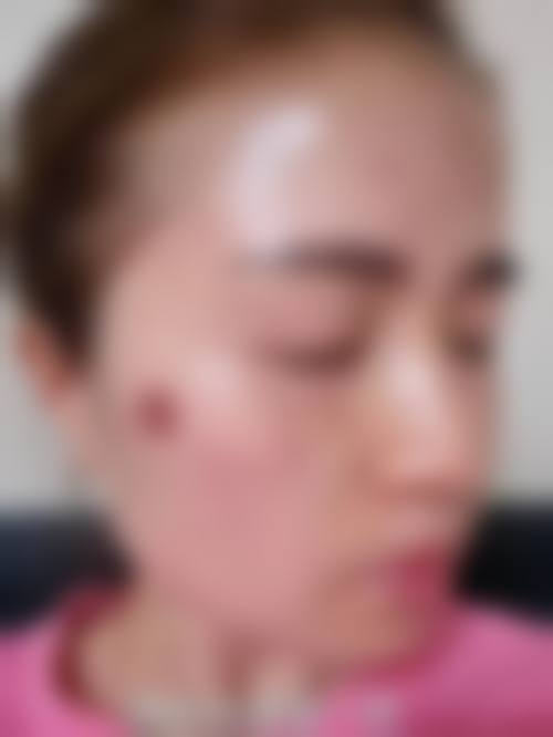 九、深圳广美整形医疗美容门诊部真实的患者评价