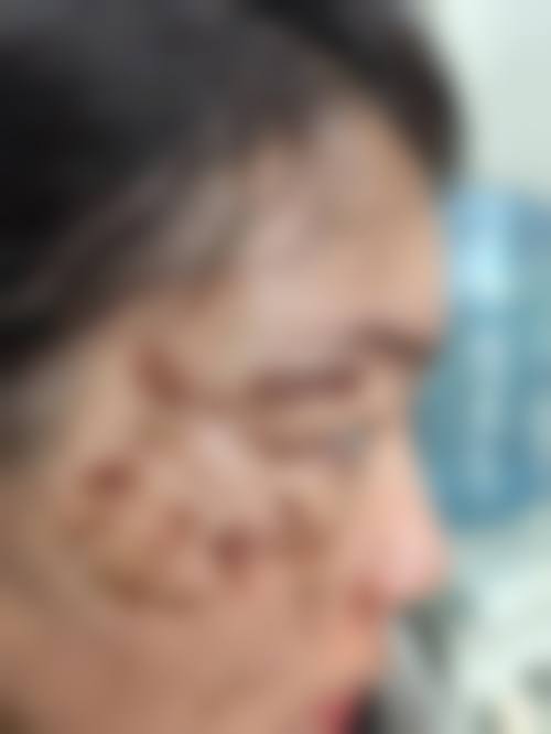 六、深圳广美整形医疗美容门诊部价格表