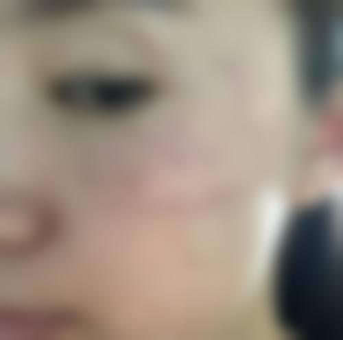 二、深圳广美整形医疗美容门诊部怎么样？