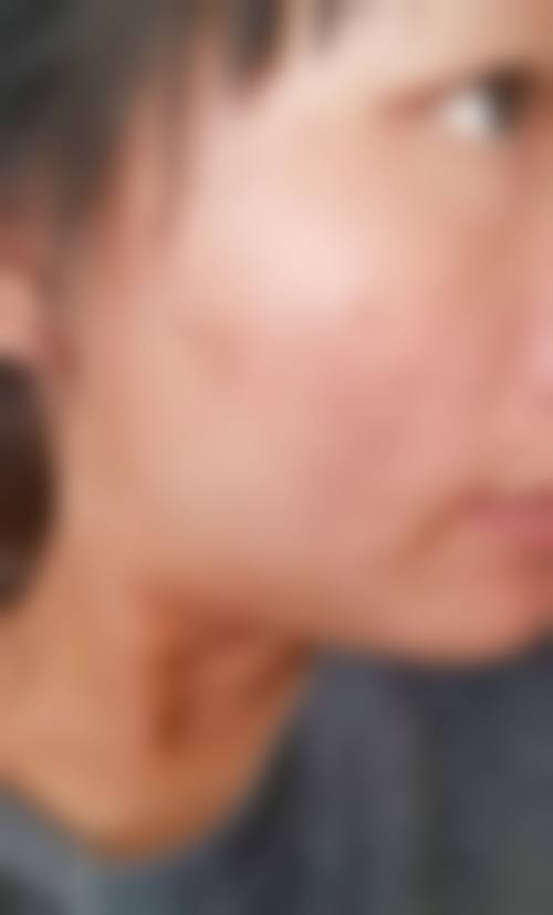 二、CLINICX无创微整形中 心怎么样？