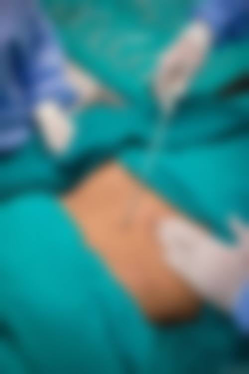 八、攀枝花梦菲思整形医院真实的患者评价