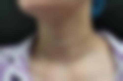 九、西双版纳勐海县人民医院医学美容中 心真实的患者评价