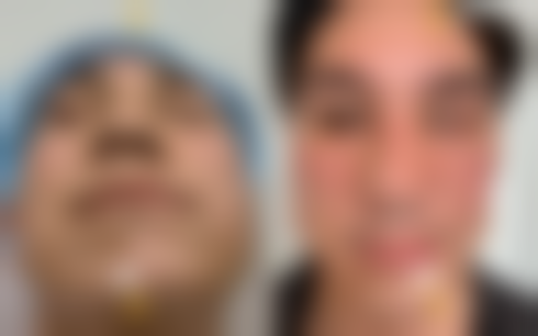 八、宁波首美医疗美容门诊部真实的患者评价