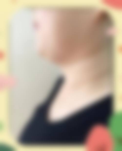 九、TCB中央美容外科仙台广濑通真实的患者评价