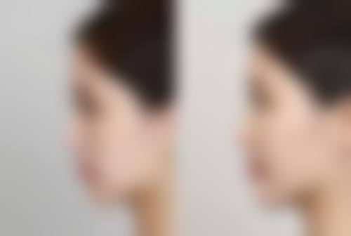 六、复旦大学附属华 山医院(整形外科)地址及交通