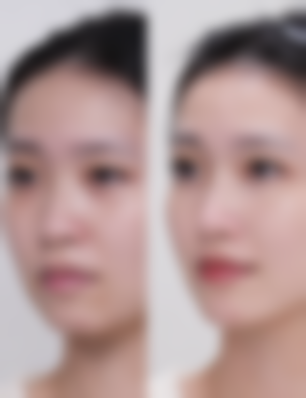 三、淄博张店丽美医疗美容门诊部诊疗项目有哪些？