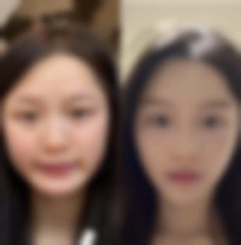 三、地区消费水平差异导致阴道紧缩术价格不同