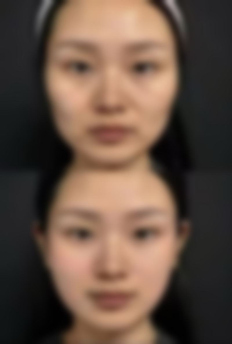 四、其他常见修复方法细说