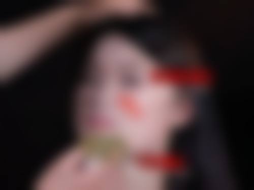 打瘦脸针要注射费吗