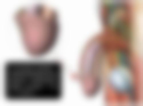 三、怎么快速的消除眼袋之分类型解决方案