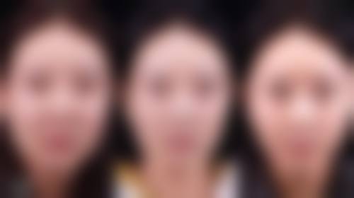 怎么去20多年的旧疤痕？多种医美手段助你淡化颜色、平整表面、缩小面积 