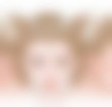 四、怎样去掉缝针后的疤痕：其他辅助方法