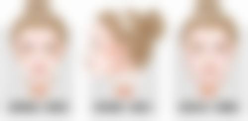 {疤痕疙瘩怎么修复较好？药物、激光、手术等多种方法为你揭秘修复之道 