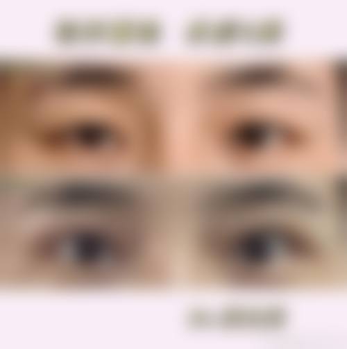 九、韩国JY整形外科真实的患者评价