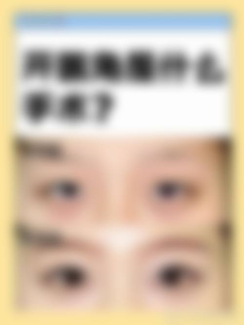 四、韩国JY整形外科特色项目