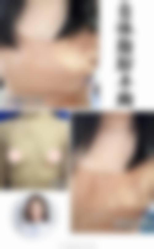 四、汕头紫馨医疗整形特色项目