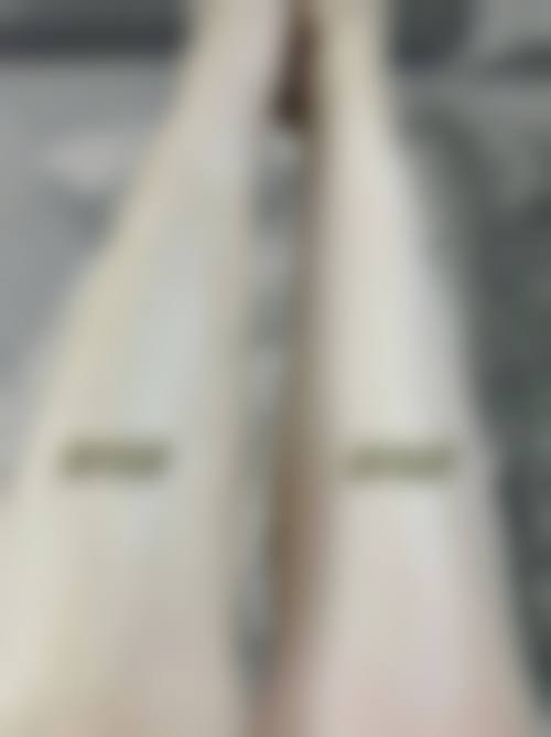 三、韩国JY整形外科诊疗项目有哪些？