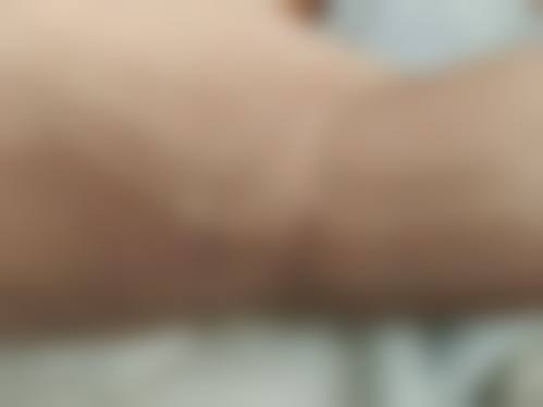 八、韩国精细美研(Pinpoint Lab SMP)医院真实的患者评价