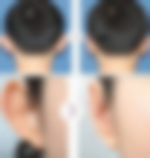 八、杭州佰欧克医疗美容诊所预约方式